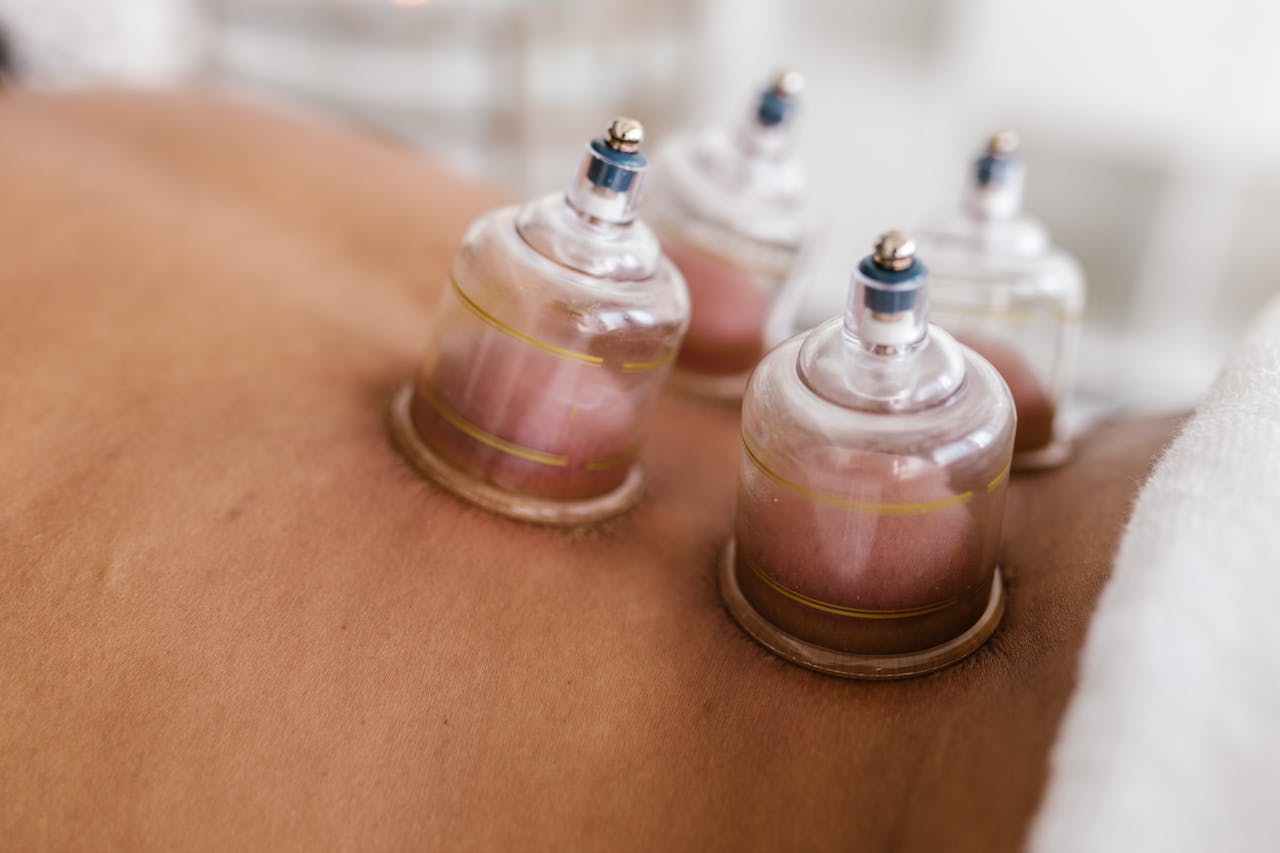 Revitalise Your Body with Cupping Therapy at Awe Spa Massage